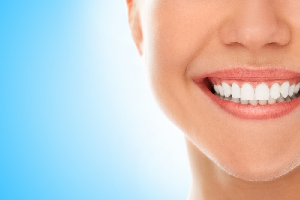 cosmetic teeth whitening houston